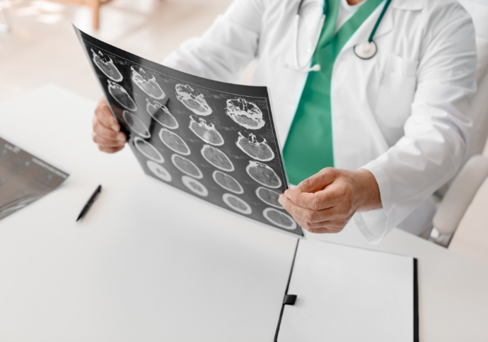 NEUROLOGÍA - EPILEPSIA